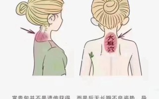 儿童富贵包是怎么形成的？需要从不良姿势、骨骼发育还是脂肪堆积找原因？