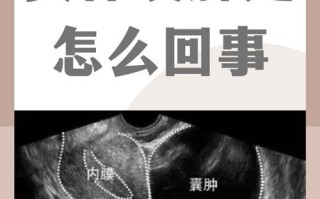 怀孕期间卵巢黄体囊肿