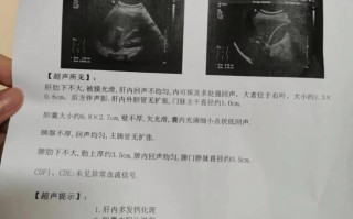 孕期胆汁淤积检查什么