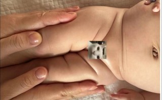 新生儿腿部纹理不对称是正常现象还是疾病信号？需警惕哪些潜在问题？