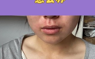 孕期皮肤变差真能预示胎儿性别是男孩吗？科学依据是什么？