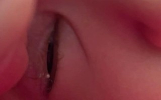 新生儿眼角出现白色泡泡是正常现象还是疾病信号？