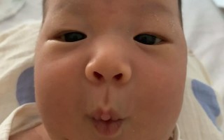 新生儿为何天生呈现三角嘴形状？是发育特征还是异常信号？
