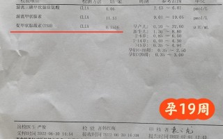 孕期没查过甲状腺功能，会影响宝宝健康吗？后悔没早点检查怎么办？