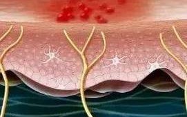 孕期复发性生殖器疱疹会对胎儿造成哪些影响？该如何科学应对？