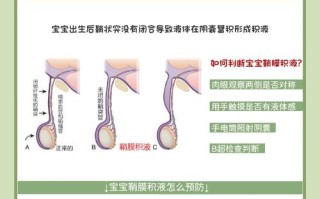 新生儿鞘膜积液因何形成？