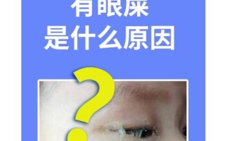 新生儿为什么总爱长眼屎？是上火还是生病了？新手爸妈别慌！
