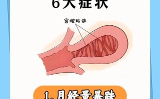 孕期发现宫腔粘连带会引发哪些风险？如何科学处理才能保障母婴安全？