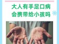 儿童手足口病会传染给大人吗？