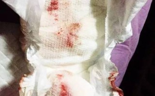 新生儿眼鼻耳分泌物多，正常还是异常？如何正确护理与应对？