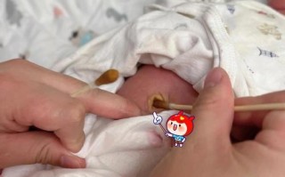 新生儿肚脐根部未脱落，家长该如何正确护理与观察呢？