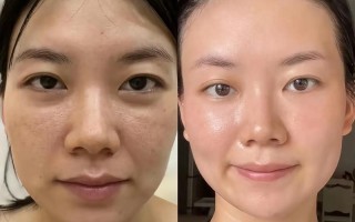 孕期不小心吃到护肤品