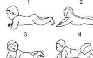 新生儿肌张力低有哪些具体症状？家长该如何早期识别与干预？