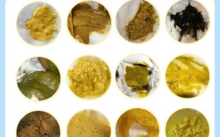 新生儿36小时未排便，是正常攒肚还是需警惕的健康信号？