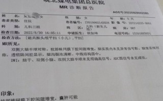新生儿黄疸400必须做磁共振吗？