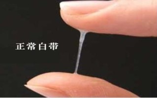 孕期分泌物增多且有异味，是正常现象还是感染信号？需警惕哪些异常情况？
