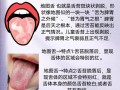 儿童舌头痒是什么原因