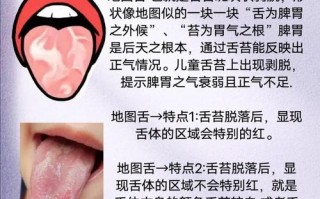 儿童舌头痒是什么原因