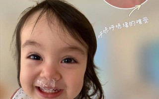 新生儿打喷嚏喷出口水