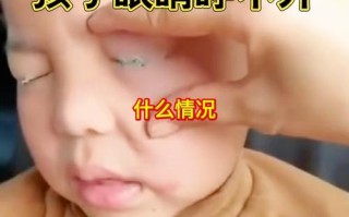 新生儿一只眼睛没睁开