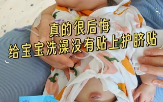 新生儿肚脐护理时喷的药水具体叫什么名字？