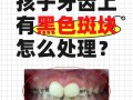 儿童牙齿长出难看黄斑，到底用什么方法才能彻底去除？