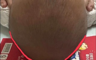 新生儿24小时不睡觉是异常信号还是正常生理现象？