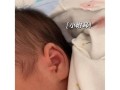 新生儿耳朵旁长福耳是福兆还是异常？需要关注哪些健康问题？