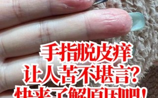 儿童手指脱皮是缺维生素还是皮肤病？