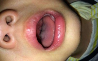 感觉新生儿喉咙有东西