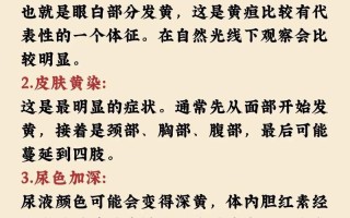 新生儿黄疸的发生究竟与哪些关键因素密切相关？