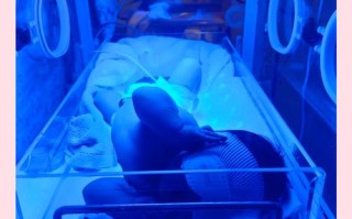 新生儿照蓝光真的难受吗？会对宝宝造成哪些影响？