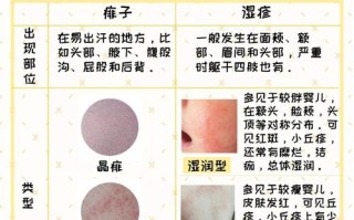 儿童过敏性湿疹反复发作，日常护理与治疗该如何科学应对？