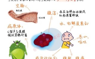 新生儿结肠坏死治愈率高吗？治疗后会有后遗症吗？