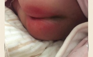 新生儿放屁时脸憋通红是正常现象吗？需要担心吗？