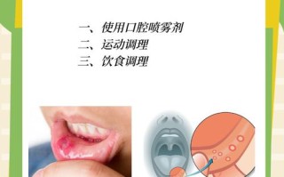 孕期怎么治疗口腔溃疡