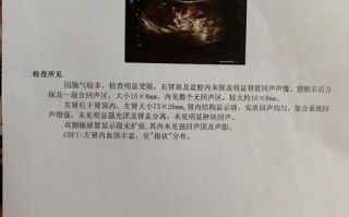 新生儿一个肾影响大吗