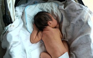 新生儿溶血性黄疸晒太阳真的能退黄吗？晒多久、怎么晒才安全有效？