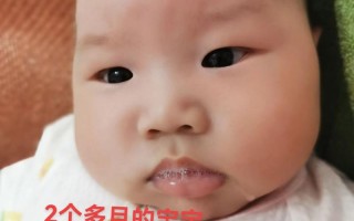 新生儿口吐泡泡能拉丝是正常现象还是异常信号？