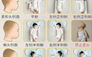 新生儿睡觉时头部固定不当会导致偏头吗？正确固定姿势有哪些注意事项？