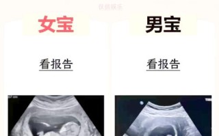 孕期食量暴增真能预示宝宝性别？科学依据还是民间传说？