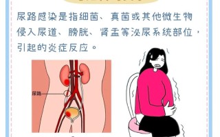 孕期尿路感染有哪些典型症状？需警惕哪些异常信号？