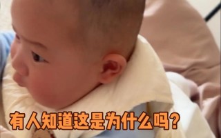 新生儿两侧头凹凸不平是正常现象吗？需要警惕哪些潜在问题？