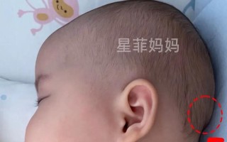 新生儿前头骨凹凸不平是正常生理现象还是异常信号？需警惕哪些潜在问题？