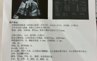 孕期四维彩超到底该做几次？两次检查有必要吗？