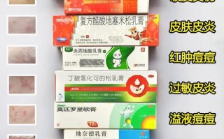 新生儿湿疹用药安全第一，到底该如何选择才有效？