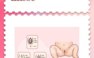 新生儿脐带迟迟不脱落，家长该如何正确护理和处理？