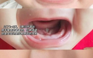 新生儿牙龈肿大是正常现象吗？需要干预吗？