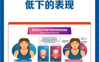 新生儿甲低症状有哪些？