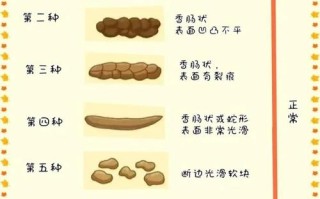 新生儿粑粑干燥怎么办